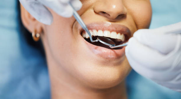 Best Root Canal Emergency Dentist  in Cedar Springs, MI