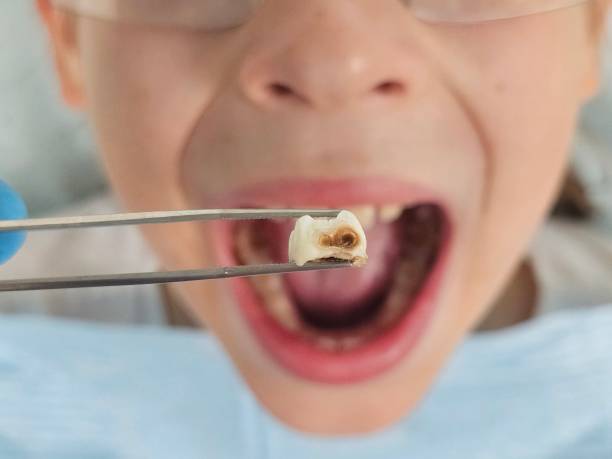 Best Cracked Tooth Emergency Dentist  in Cedar Springs, MI